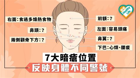 耳邊暗瘡|【暗瘡位置】不同代表什麼？中醫教如何處理及預防